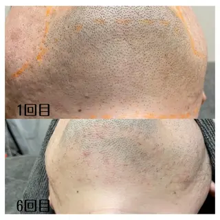 DUPE&MORE 店長kanaeのエステ・リラクイメージ