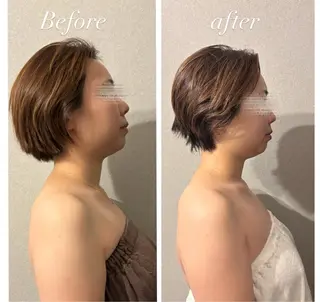 圧倒的たるみ改善 美容鍼エステのエステ・リラクイメージ