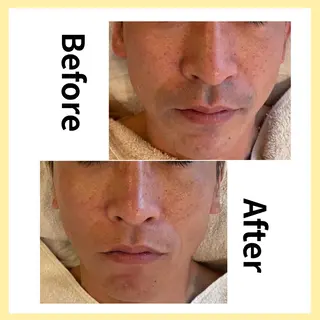 セルフ脱毛/美尻イス キングスサロン熊本のエステ・リラクイメージ