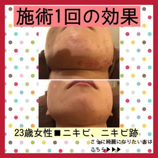 ミディアム カラー パーマ ヘアアレンジ メンズ キッズ ネイル マツエク・マツパ ニキビ・肌質改善専門 ♡人生が変わるサロンのエステ・リラクイメージ