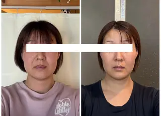 丸顔さんの救世主 高田 くみのエステ・リラクイメージ