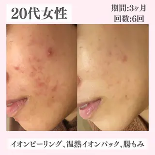 ニキビ・肌質改善専門 ♡人生が変わるサロンのエステ・リラクイメージ