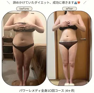《本気痩せ×疲労改善 》  BILOOPのエステ・リラクイメージ