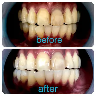 ネイル two nailのネイルデザイン