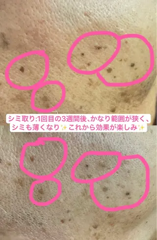 エレガンテ　ビューティーサロン所属・🎀エレガンテ🎀 美肌専門👸本間のその他イメージ