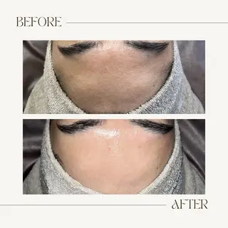 1st｜フェイシャル エステ専門店のエステ・リラクイメージ