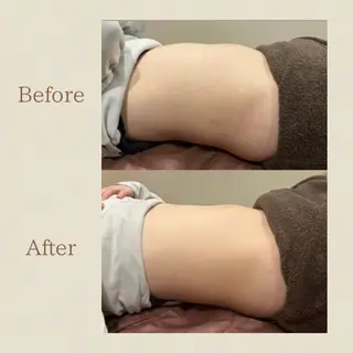 【腸もみ/冷却痩身】 お腹エステ/恵比寿のエステ・リラクイメージ