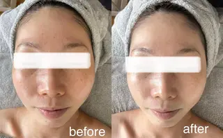 Lavi&所属・肌質改善サロン Ｌａｖｉ＆のその他イメージ