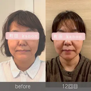 小顔矯正サロン町田 逸見智美のエステ・リラクイメージ