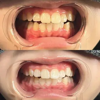 YuA beauty所属・YuA beautyのマツエク・マツパデザイン