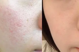 朝重い人専用 肩甲骨調整のエステ・リラクイメージ