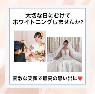 ホワイトニング ショップ伊丹店のその他イメージ