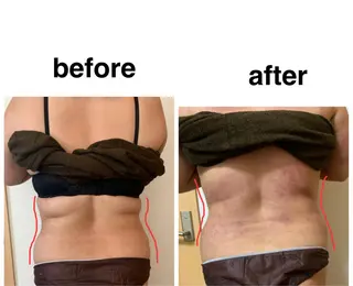 痩身/脱毛/ネイル HARUKAのエステ・リラクイメージ