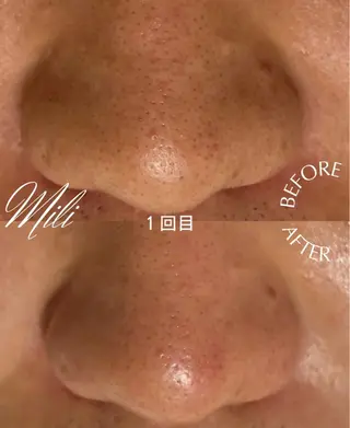 毛穴専門店 mili柏のエステ・リラクイメージ