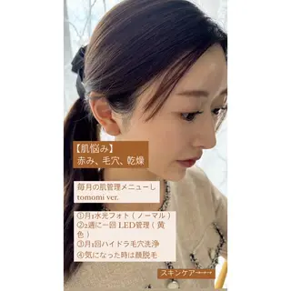 【韓国肌管理・脱毛】 クレセントのその他イメージ