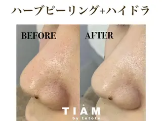 美肌サロンTIAM by tetoteのエステ・リラクイメージ