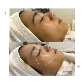 🌺 SAKI 🌺のマツエク・マツパデザイン