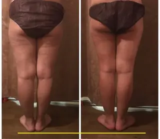 代表 MOMOのエステ・リラクイメージ