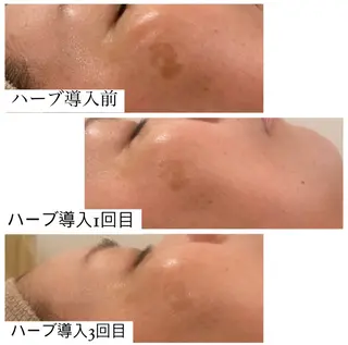 トータルビューティ サロンstageのエステ・リラクイメージ