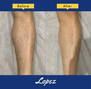 メンズ メンズ脱毛エステサロンロペス所属・小池 里穂のエステ・リラクイメージ