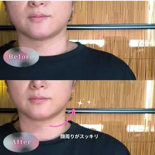 メンズ 肩こり・首コリ 専門店Fuüのエステ・リラクイメージ