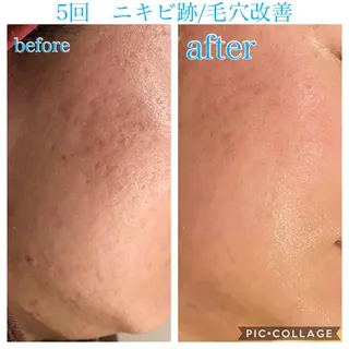 ロング カラー パーマ ヘアアレンジ キッズ ネイル マツエク・マツパ EnsorClair 代表 野口真央のエステ・リラクイメージ