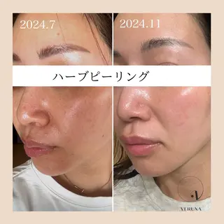 ピーリング専門店 Belluteのエステ・リラクイメージ