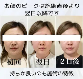 小顔と ヘッドスパのお店のエステ・リラクイメージ