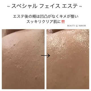 ビューティー ミロワールのエステ・リラクイメージ