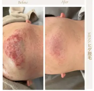 メンズ 脱毛＆フェイシャル/ Rappore;増田のエステ・リラクイメージ