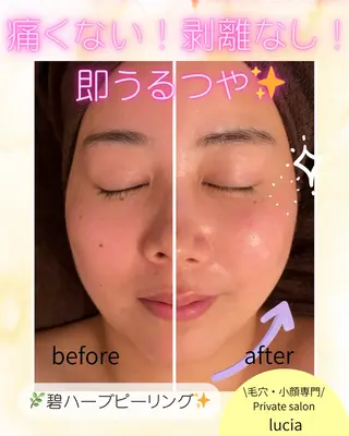 ビューティーサロンルシア所属・lucia  豊明 肌管理のエステ・リラクイメージ