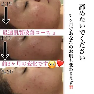 ミディアム カラー パーマ ヘアアレンジ メンズ キッズ ネイル マツエク・マツパ ニキビ・肌質改善専門 ♡人生が変わるサロンのエステ・リラクイメージ