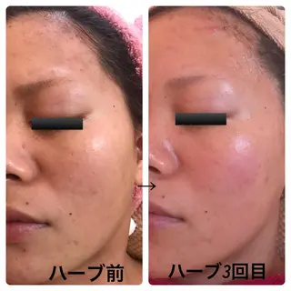 fairyrose organicエステのエステ・リラクイメージ