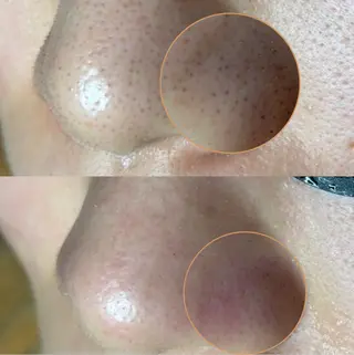 beauty salonN.11のエステ・リラクイメージ