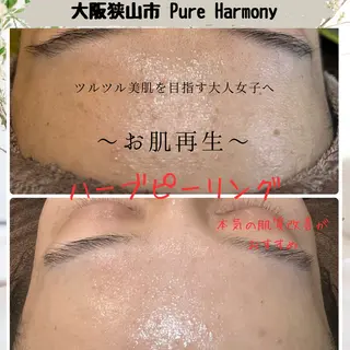 ハーブ/小顔/リンパ /大阪狭山市のエステ・リラクイメージ