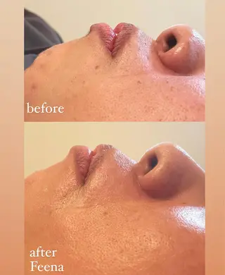 amu nail. RINAのネイルデザイン