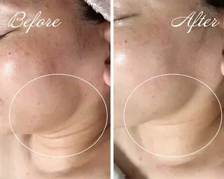 村上 玲奈のエステ・リラクイメージ