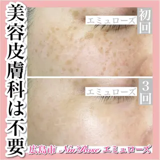 Nm'Rose(エミュローズ)所属・Nm'Rose .エミュローズのエステ・リラクイメージ