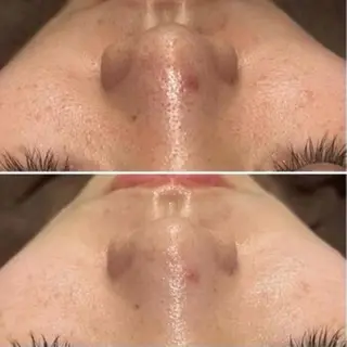 エヴァーグレース 金山店のエステ・リラクイメージ