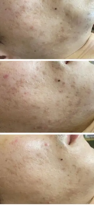 メンズ 朝重い人専用 肩甲骨調整のエステ・リラクイメージ