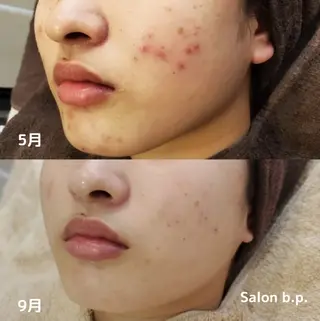 Salon b.p. 渋谷のエステ・リラクイメージ