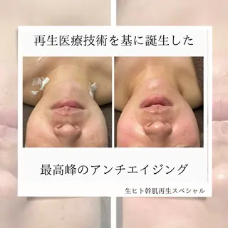 ベルフェリーチェ 早織のエステ・リラクイメージ