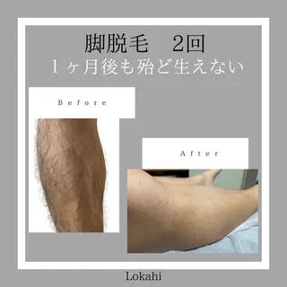 脱毛サロン Lokahiのエステ・リラクイメージ