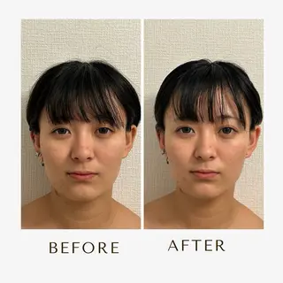 小顔セラピー LILのエステ・リラクイメージ