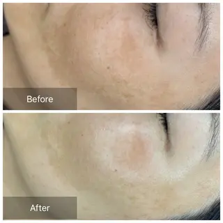 トータルしみケア専門 NICA(ニカ)の眉毛・アイブロウイメージ