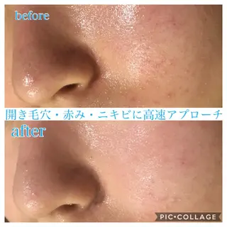 セミロング カラー パーマ ヘアアレンジ キッズ ネイル マツエク・マツパ EnsorClair 代表 野口真央のエステ・リラクイメージ