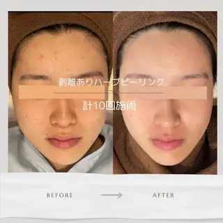 Life Salon別府店のエステ・リラクイメージ