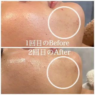 Nna 韓国肌管理のエステ・リラクイメージ