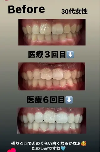 Kaula ホワイトニング🦷✨のエステ・リラクイメージ