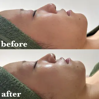 メンズ 肌質改善＆脱毛 【M Mondo】のエステ・リラクイメージ